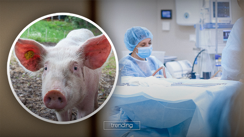 211021-pig-transplant-header.jpg