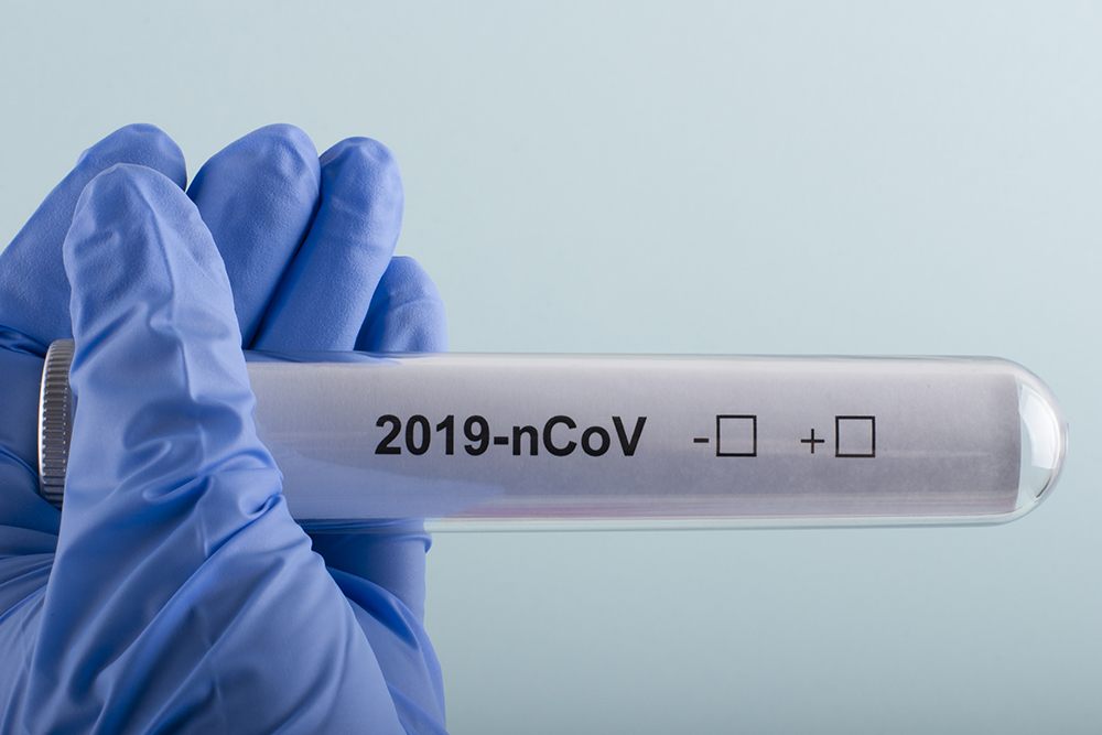 Coronavirus 2019-nCoV concept. Hand in medical glove holding test tube with inscription 2019-nCoV. Coronavirus test. Wuhan coronavirus outbreak, influenza pandemic virus infection.